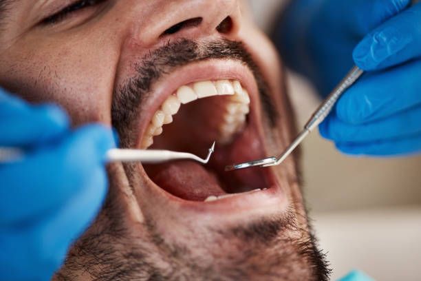 Best Cracked Tooth Emergency Dentist  in Biscayne Park, FL